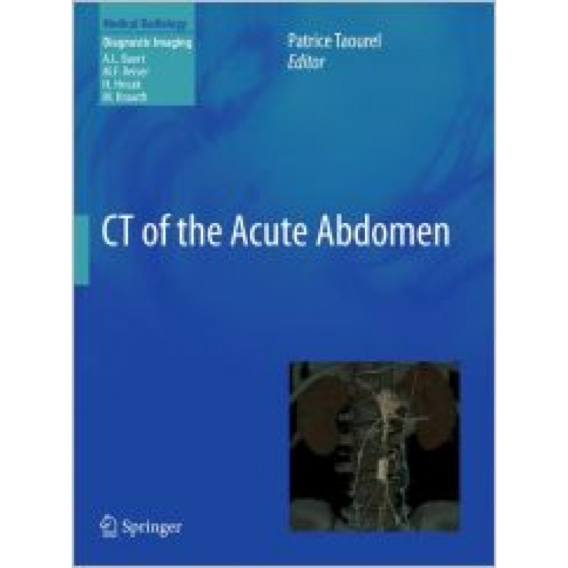 CT of the Acute Abdomen